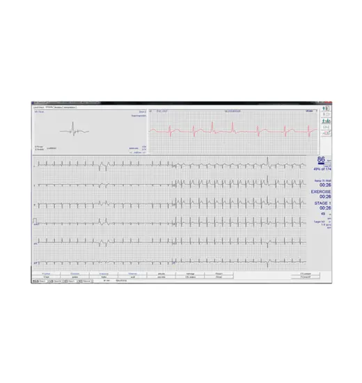 CardioSoft ECG output report.