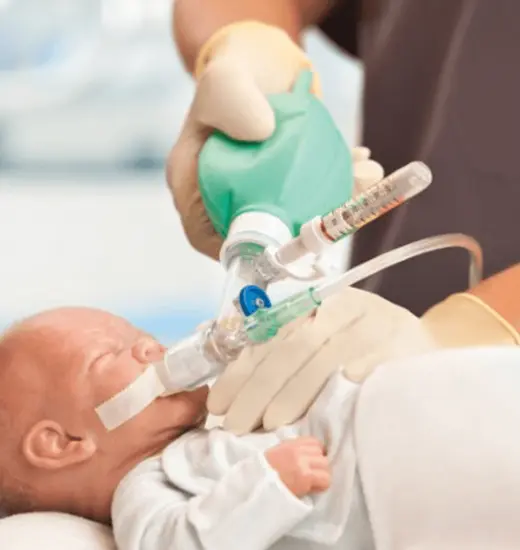 Infant resuscitation with a Vyaire flow-inflating resuscitation device.